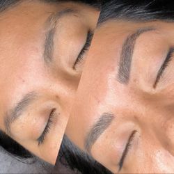 Brow