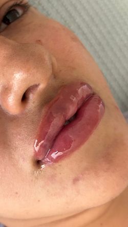 Lip