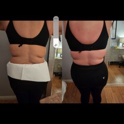 Body Sculpting