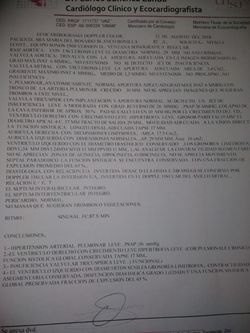 Ceiling mount bike hoist (2)