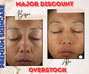Premium skincare - overstock discount