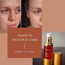 Efecto Lift Sin Cirugía