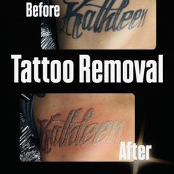 Removal