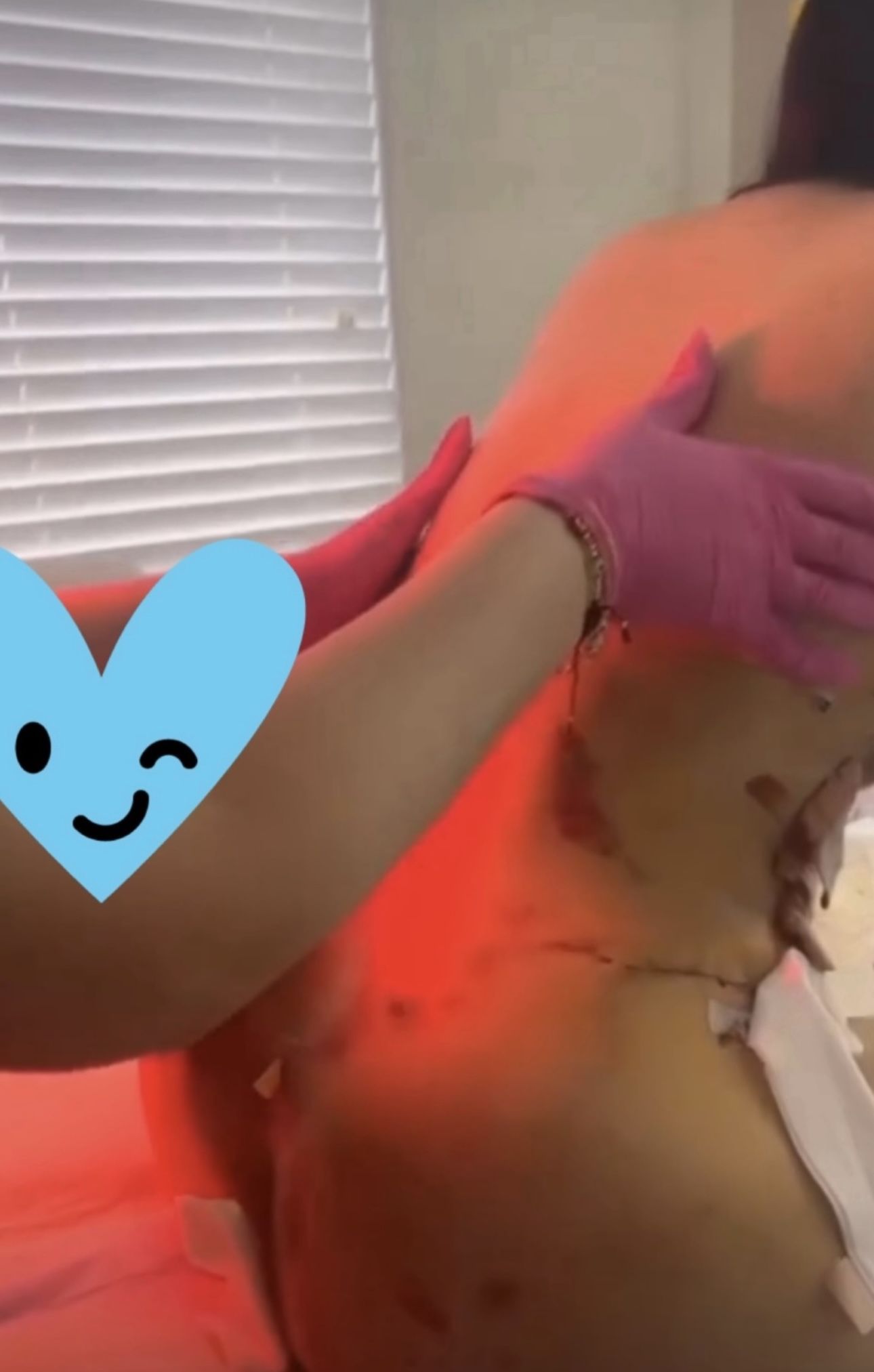 Te Realisaste Una Lipo ❤️🩹🩸