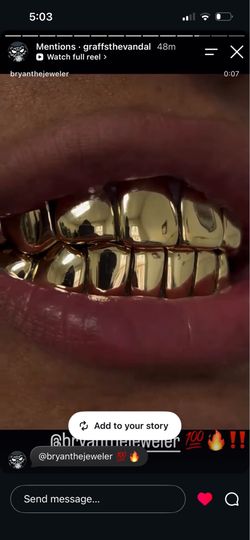 Grillz , Gold Grillz