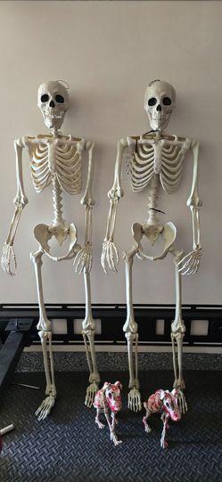 Life-Size Halloween Skeleton Decorations – Set of 2