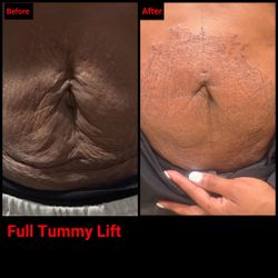 Tummy Tightening