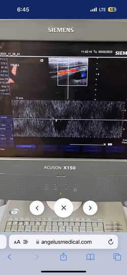 Siemens Acuson X150