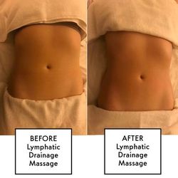 Massage Linfático / Lymphatic Massage