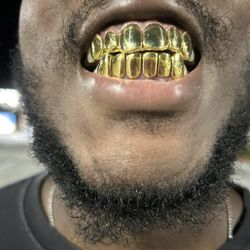 NPG Grillz Contact For Prices 