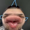Mo