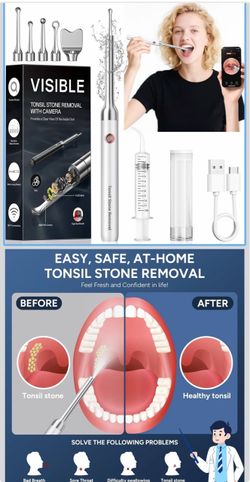 Tonsil Stone Remover with Camera - Upgraded Visual Tonsil Stone Removal Kit