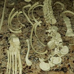 Bone Clones