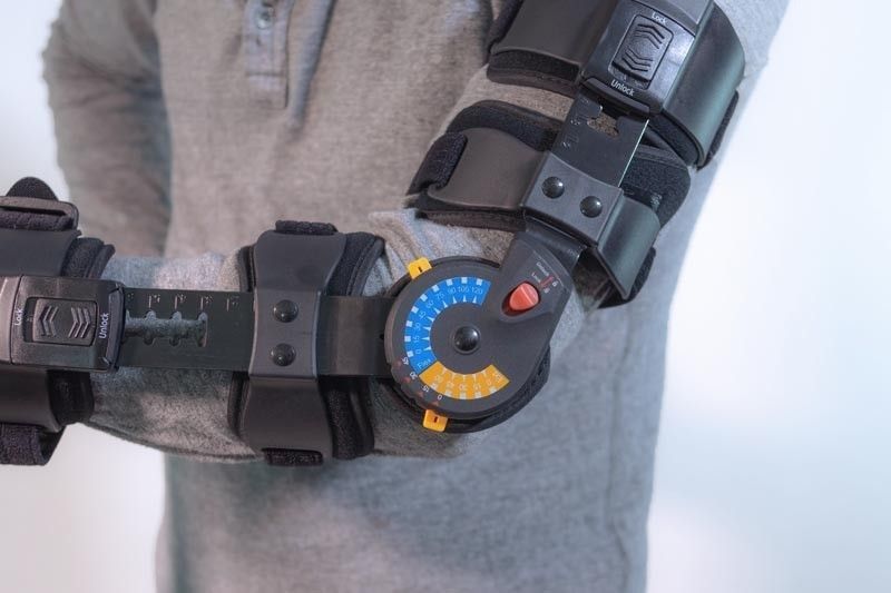 Left Elbow Arm Cast