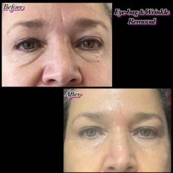 Skin Care & Skin Tightening 