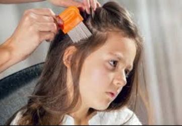 Hair lice Removal comb