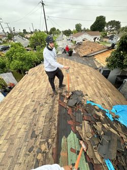 Shingles