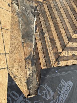 Shingles