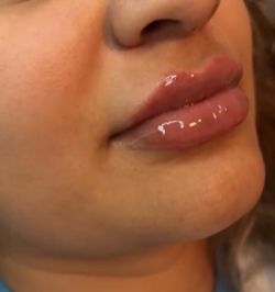 Lip Gloss