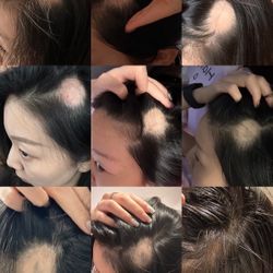 Keranique Lift & Repair Treatment Spray