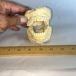 Vintage Dental Cast Model Teeth Oddities Collectible