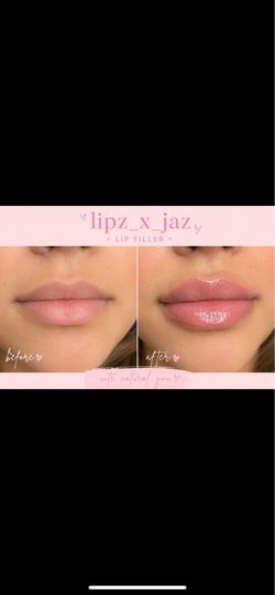 Lipfiller ! 1.1ml!