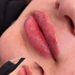 Lips