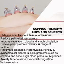Cupping Therapy