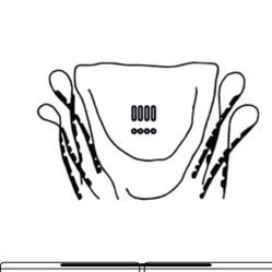 BUG  54-67 Whole Body Gaskets
