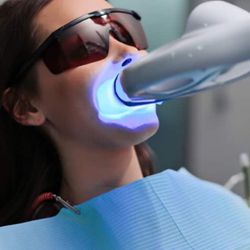 Teeth Whitening Treatments 