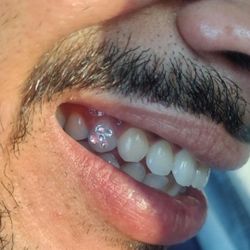 Tooth Gems