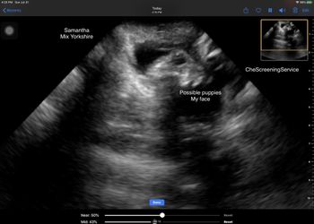 Ultrasound
