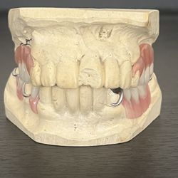 Acrylic Framework Dentures 