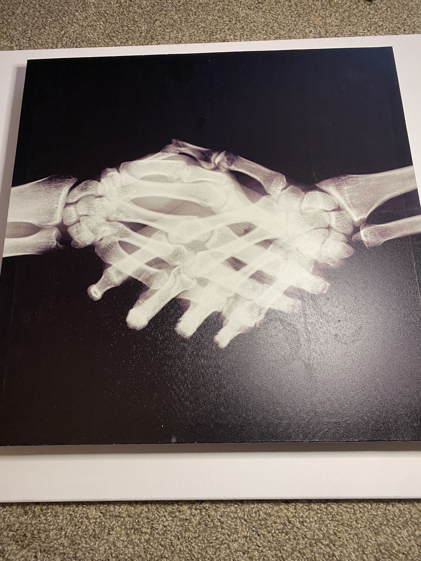 X Ray canvas Art