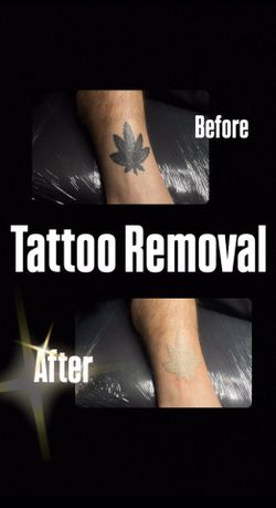 Removal