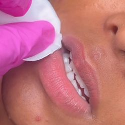 Lip Blush Neutralization 