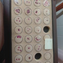 Pink Tourmaline Aprox. 87 Pieces, 