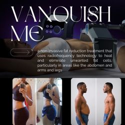 $100 Off Body Shaping Treatment 