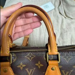 Louis Vuitton Speedy - Smooth and Elegant Transformation