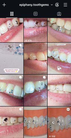 Professional Tooth Gems