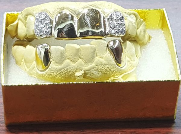 8k 10k 14k 18k Gold Teeth Grillz Permanent Also Available 8k 10k 14k 18k Gold Teeth Grillz Permanent Also Available Jewelry Accessories In Arlington Tx Offerup