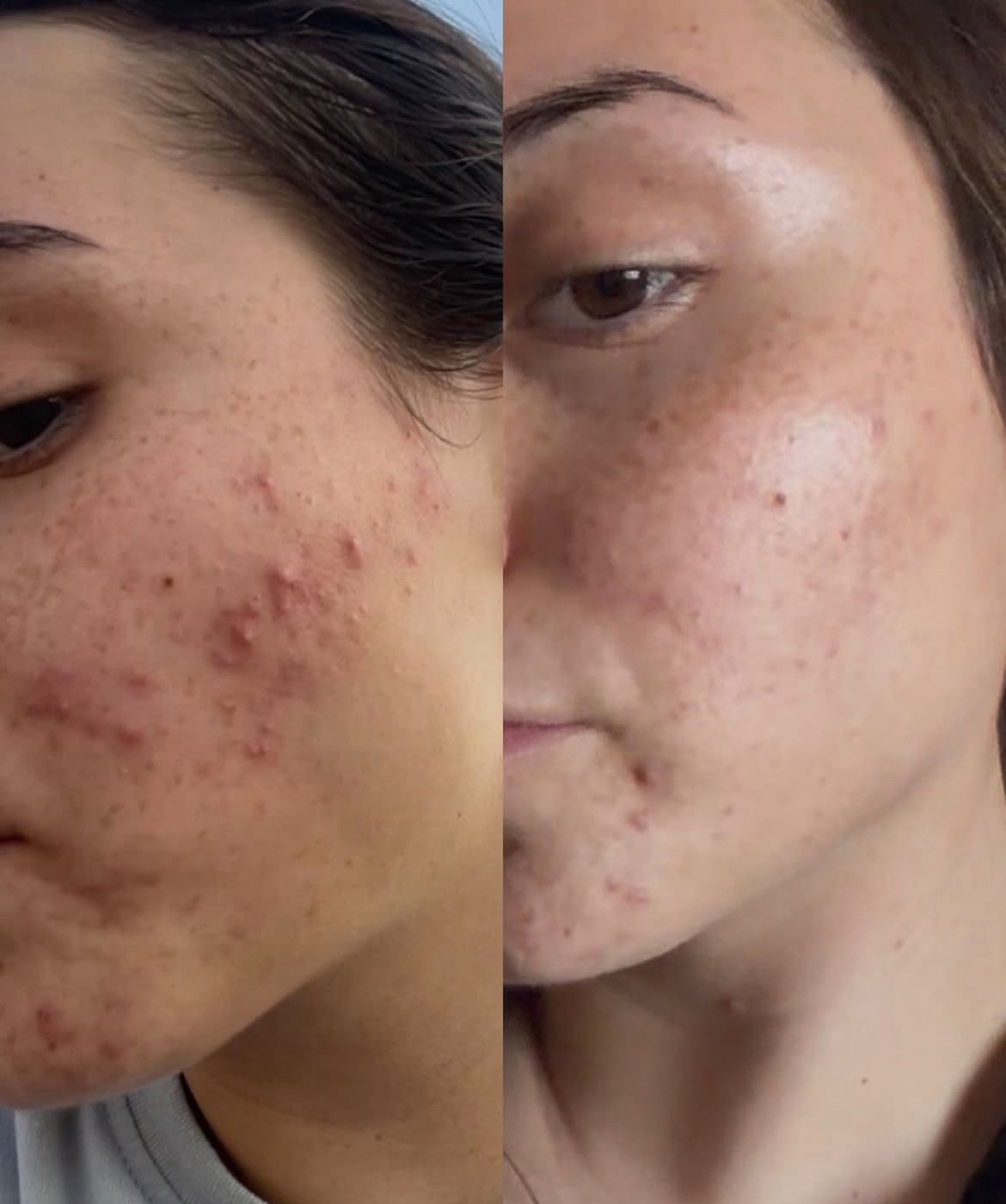 Custom Facial PreciosaSkn