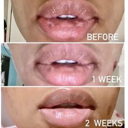 Lip Brightening Cream