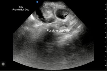 Ultrasound