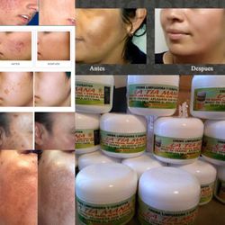 Tía Mana Crema Para Desmanchar 100%