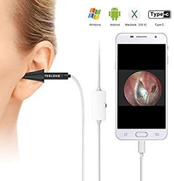 Otoscope USB Ear Otoscope Inspection Camera with 6 LED Lights for Android Samsung LG Sony Smartphones Mac and PC