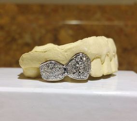 Custom gold teeth with permanent look!