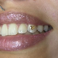 Tooth Gems 💎