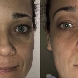 Better Skin Care