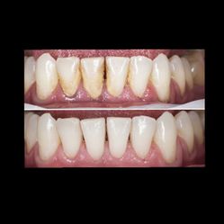 Dental